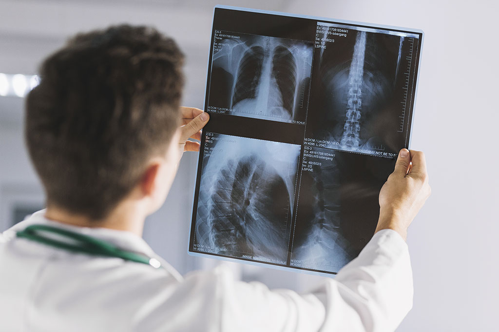 Medical Insurance web page Featured Image - Picture of a medical doctor (or radiologist) inspecting x-rays